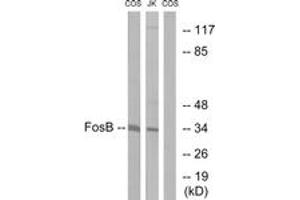 Western Blotting (WB) image for anti-FBJ Murine Osteosarcoma Viral Oncogene Homolog B (FOSB) (AA 12-61) antibody (ABIN2888837) (FOSB anticorps  (AA 12-61))