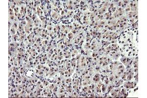 Image no. 1 for anti-HRas proto-oncogene, GTPase (HRAS) antibody (ABIN1498716) (HRAS anticorps)