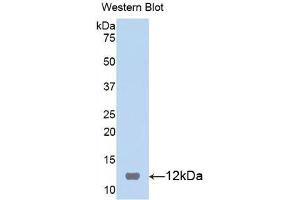 Western blot analysis of the recombinant protein. (S100B anticorps  (AA 1-92))