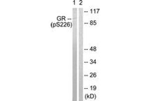Western blot analysis of extracts from Jurkat cells treated with EGF 200ng/ml 15', using GR (Phospho-Ser226) Antibody. (GR (AA 201-250), (pSer226) anticorps)