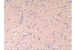 IHC-P analysis of Human Brain Tissue, with DAB staining. (POR anticorps  (AA 77-518))