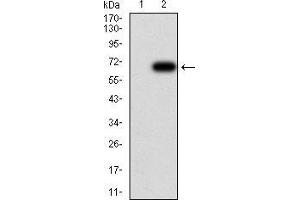 Western Blotting (WB) image for anti-Histone Deacetylase 6 (HDAC6) (AA 482-800) antibody (ABIN5868621) (HDAC6 anticorps  (AA 482-800))
