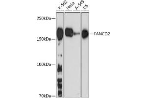 Western blot analysis of extracts of various cell lines, using F antibody (ABIN7267126) at 1:1000 dilution.