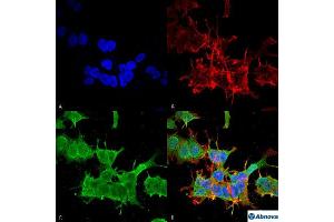 Immunocytochemical staining of SK-N-BE with SPTBN4 monoclonal antibody, clone S393-2 .