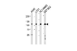 Western blot analysis of lysates from A549,,NCI-,U87-MG cell line (from left to right),using ZNF41 Antibody (N-term) (ABIN1538965 and ABIN2849171). (ZNF41 anticorps  (N-Term))