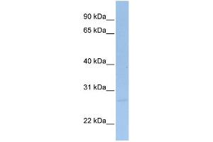 WB Suggested Anti-SIGIRR Antibody Titration:  0. (SIGIRR anticorps  (C-Term))