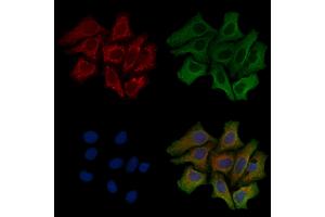 ABIN6258154 and ABIN6275445 staining Hela cells by IF/ICC. (RAPGEF3 anticorps  (C-Term))