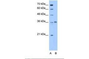 Image no. 1 for anti-Aldolase C, Fructose-Bisphosphate (ALDOC) (N-Term) antibody (ABIN6738437) (ALDOC anticorps  (N-Term))
