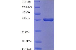 SDS-PAGE (SDS) image for Heme Oxygenase (Decycling) 1 (HMOX1) (AA 3-288), (partial) protein (His tag) (ABIN5709671)