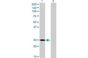 Western Blot analysis of RALB expression in transfected 293T cell line by RALB MaxPab polyclonal antibody. (RALB anticorps  (AA 1-206))