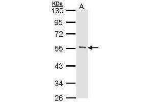 WB Image Sample (30 ug of whole cell lysate) A: Hela 10% SDS PAGE antibody diluted at 1:1000 (MEF2A anticorps  (N-Term))