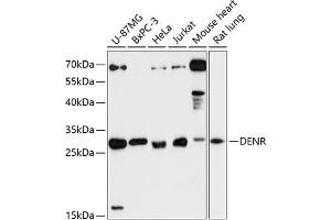Western blot analysis of extracts of various cell lines, using DENR antibody (ABIN6133498, ABIN6139534, ABIN6139535 and ABIN6217790) at 1:3000 dilution. (Density Regulated Protein anticorps  (AA 1-198))