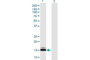 Western Blot analysis of SUMO1 expression in transfected 293T cell line by SUMO1 monoclonal antibody (M03), clone 3D7. (SUMO1 anticorps  (AA 1-101))
