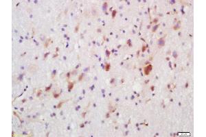 Formalin-fixed and paraffin embedded rat brain labeled with Rabbit Anti-FUT8 Polyclonal Antibody, Unconjugated  at 1:200 followed by conjugation to the secondary antibody and DAB staining (FUT8 anticorps  (AA 311-410))
