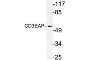 Western blot (WB) analysis of CD3EAP antibody in extracts from A549 cells. (CD3EAP anticorps)