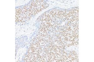 Immunohistochemistry (IHC) image for anti-Mediator Complex Subunit 1 (MED1) (AA 1550-1581) antibody (ABIN7455140) (Recombinant MED1 anticorps  (AA 1550-1581))