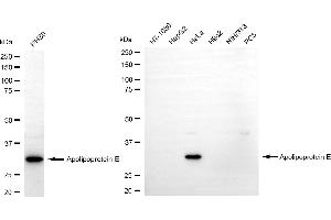 Western blotting analysis using apolipoprotein E antibody (ABIN7797629). (Recombinant APOE anticorps)