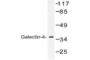 Western blot (WB) analysis of Galectin-4 antibody in extracts from COLO cells. (GAL4 anticorps)