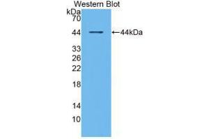 Western blot analysis of recombinant Human RANk. (TNFRSF11A anticorps  (AA 330-615))