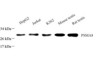 Western blot analysis of PSMA8 (ABIN7075232),at dilution of 1: 1000 (PSMA8 anticorps)