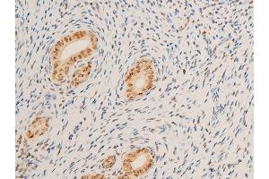 ABIN6267271 at 1/100 staining rat uterine tissue sections by IHC-P.
