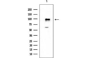 anti-Cell Cycle and Apoptosis Regulator 2 (CCAR2) (Internal Region) antibody