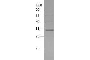 Western Blotting (WB) image for Synaptojanin 2 Binding Protein (SYNJ2BP) (AA 1-117) protein (His-IF2DI Tag) (ABIN7125267)
