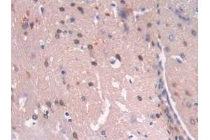 Detection of MB21D1 in Mouse Brain Tissue using Polyclonal Antibody to Mab21 Domain Containing Protein 1 (MB21D1)
