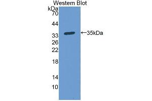Western blot analysis of the recombinant protein. (PPOX anticorps  (AA 9-300))