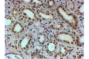 Immunohistochemistry (IHC) image for anti-Polypyrimidine Tract Binding Protein 1 (PTBP1) antibody (ABIN5874678) (PTBP1 anticorps)