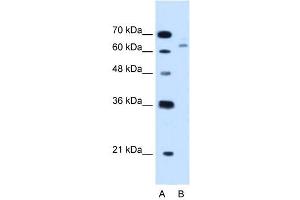 CBS antibody used at 1. (CBS anticorps  (N-Term))