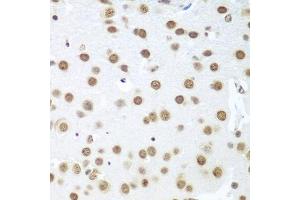 Immunohistochemistry of paraffin-embedded mouse brain using BCAS2 antibody (ABIN5972469) at dilution of 1/100 (40x lens).