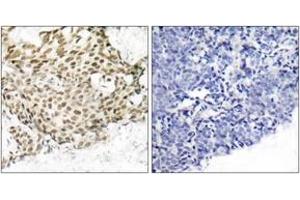 Immunohistochemistry (IHC) image for anti-Nibrin (NBN) (AA 310-359) antibody (ABIN2889031) (Nibrin anticorps  (AA 310-359))