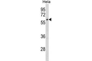 Western Blotting (WB) image for anti-Cytochrome P450, Family 7, Subfamily B, Polypeptide 1 (CYP7B1) antibody (ABIN3003910)