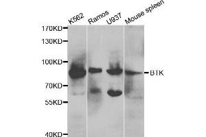 Western blot analysis of extracts of various cell lines, using BTK antibody. (BTK anticorps  (AA 30-240))