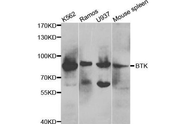 BTK anticorps  (AA 30-240)