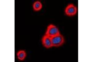 Immunofluorescent analysis of Cadherin 20 staining in HeLa cells. (Cadherin 20 anticorps)