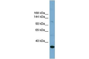WB Suggested Anti-SLC9A1  Antibody Titration: 0. (SLC9A1 anticorps  (Middle Region))
