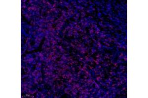 Immunofluorescence of paraffin embedded human tonsil using CD3 (ABIN7073386) at dilution of 1: 500 (200x lens)