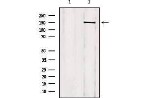 Western blot analysis of extracts from mouse brain, using TCOF1 Antibody. (TCOF1 anticorps  (N-Term))