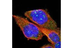 Immunofluorescent staining of human cell line A-431 shows positivity in nucleoli & cytoplasm. (PPM1B anticorps  (AA 359-463))