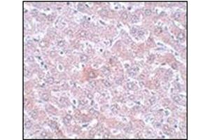 Immunohistochemistry of RSRC1 in rat liver tissue with this product at 5 μg/ml.