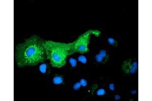 Immunofluorescence (IF) image for anti-Pyrroline-5-Carboxylate Reductase Family, Member 2 (PYCR2) antibody (ABIN1499983)