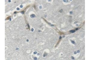 Detection of MYH14 in Human Cerebrum Tissue using Polyclonal Antibody to Myosin Heavy Chain 14, Non Muscle (MYH14) (Myosin anticorps  (AA 1069-1331))