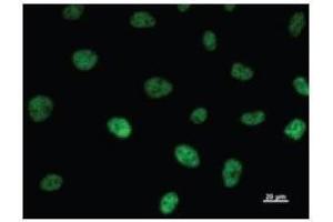 Immunostaining analysis in HeLa cells.