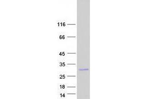 Validation with Western Blot