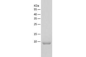 Western Blotting (WB) image for Small Ubiquitin Related Modifier Protein 1 (SUMO1) (AA 1-102) protein (His tag) (ABIN7125146) (SUMO1 Protein (AA 1-102) (His tag))