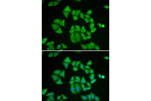 Immunofluorescence analysis of A549 cells using GSTM2 antibody. (GSTM2 anticorps)