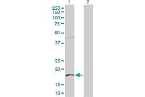Western Blot analysis of KLRG1 expression in transfected 293T cell line by KLRG1 MaxPab polyclonal antibody. (KLRG1 anticorps  (AA 1-189))
