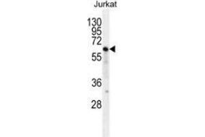 Western blot analysis in Jurkat cell line lysates (35ug/lane) using NKD2  Antibody (C-term).